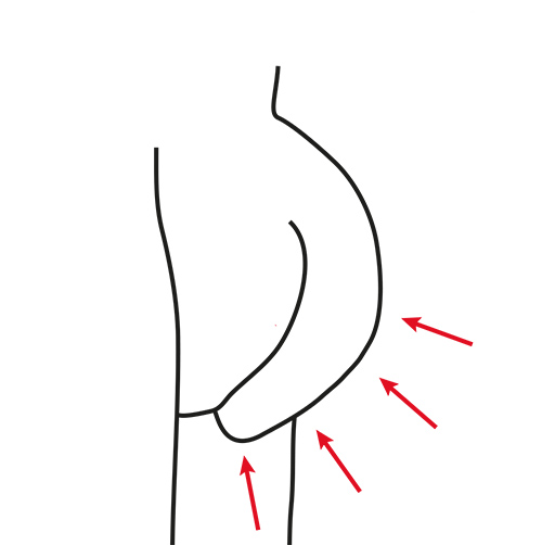 Illustration montrant comment un boxer classique maintient la verge contre le corps, créant des zones de pression et de contact au quotidien.
